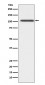Anti-ADAM17/Tace Rabbit Monoclonal Antibody